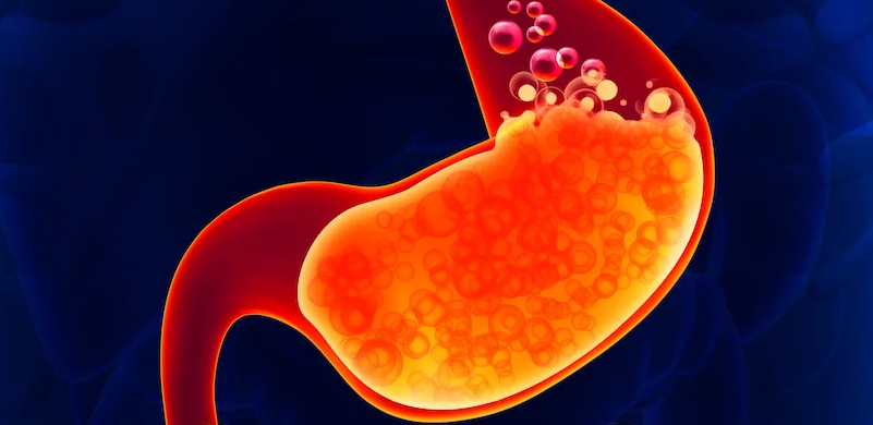 asam lambung (doktersehat)