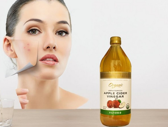 manfaat cuka apel untuk jerawat