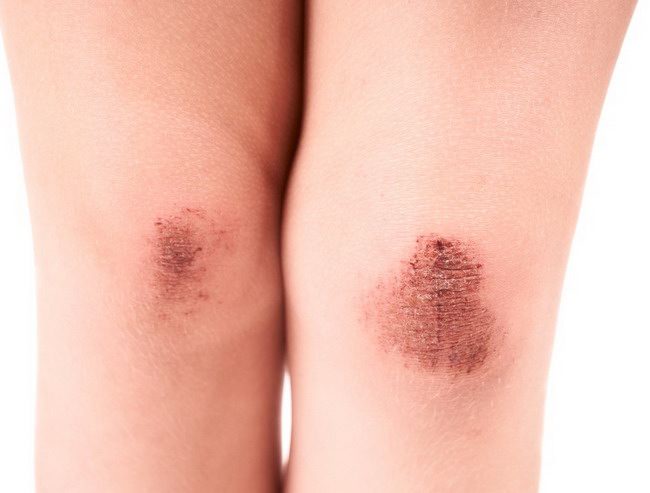 Jual madu hitam Yogyakarta